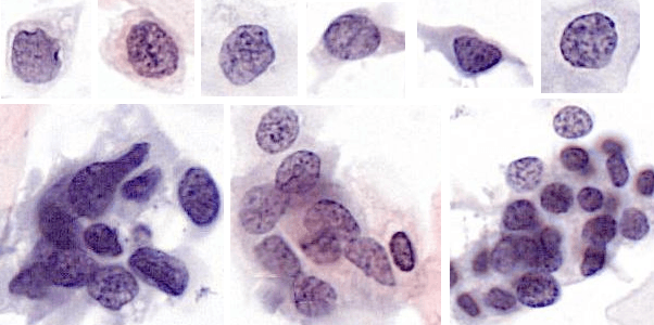 CellSolutions BestCyte Digital Cytology System